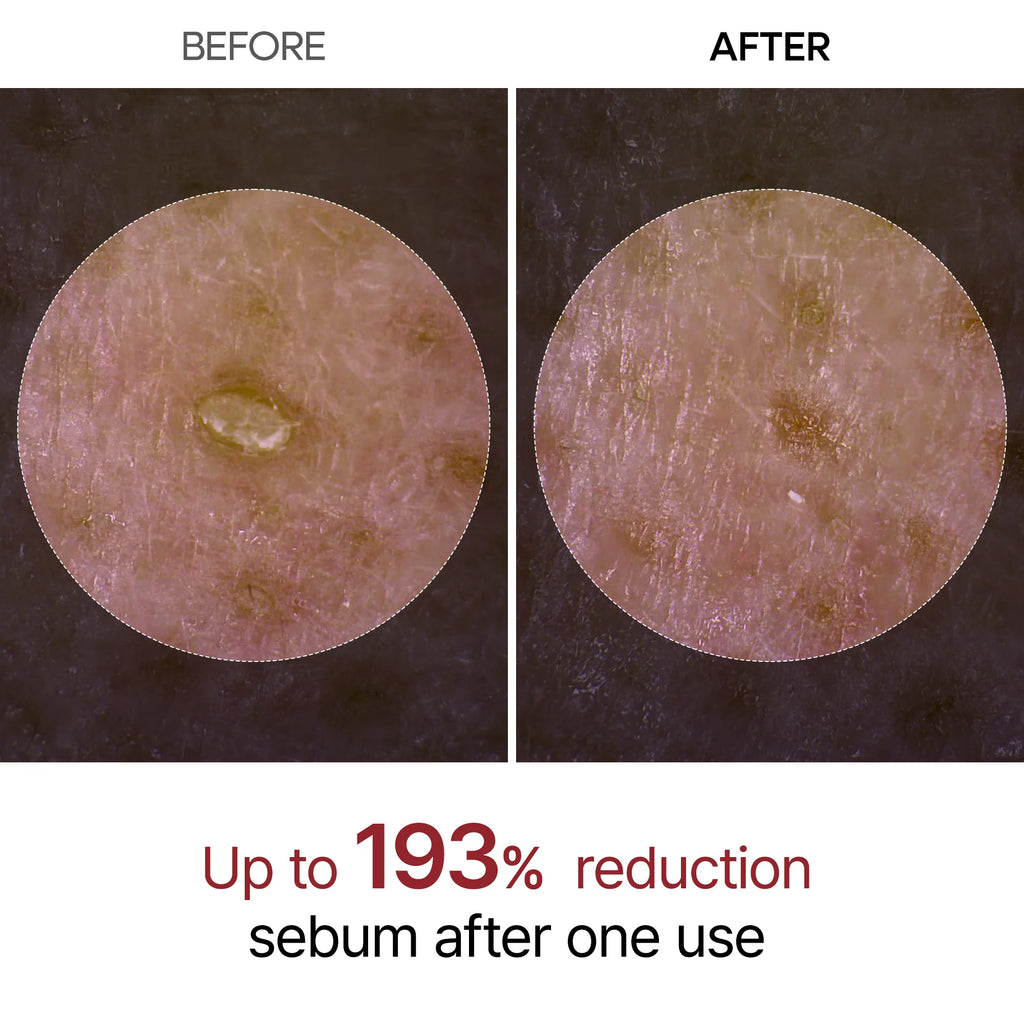 PeelShot Glow Black Rice Ampoule