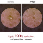 PeelShot Glow Black Rice Ampoule