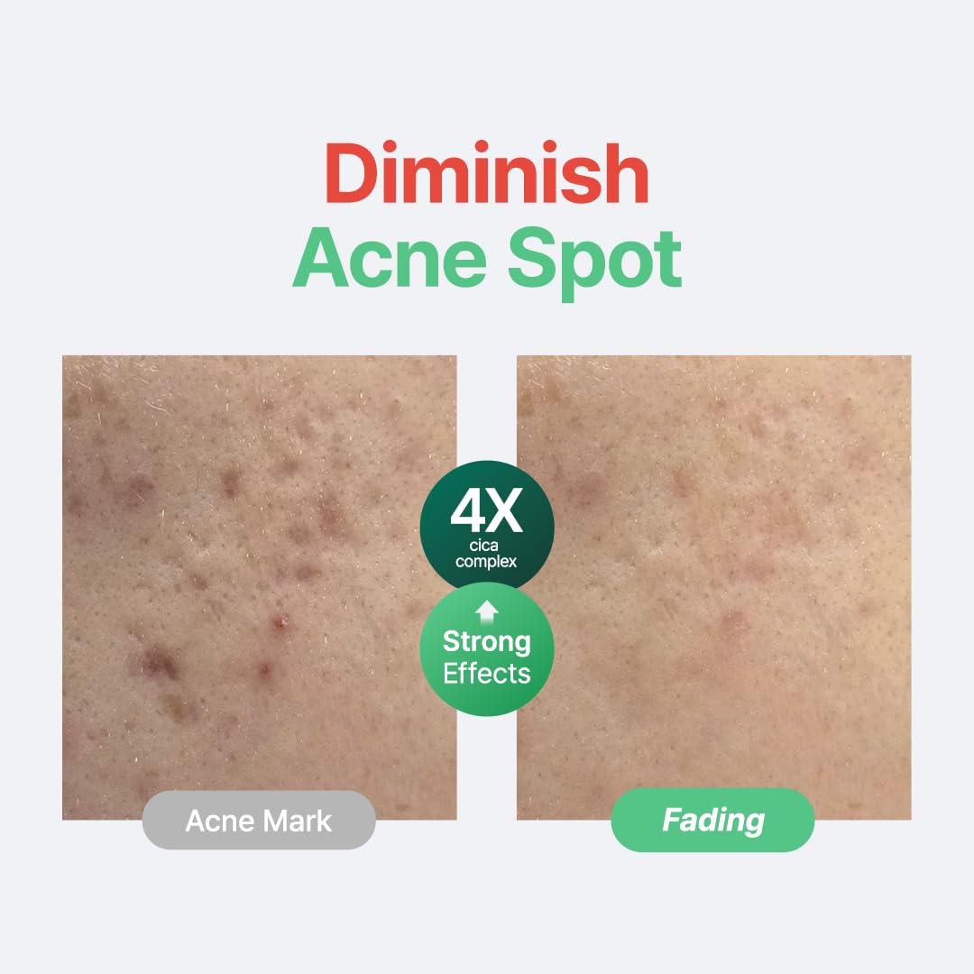 Centella Unscented Serum