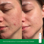 Phyto Relieful Cica PHA LHA Boosting Toner