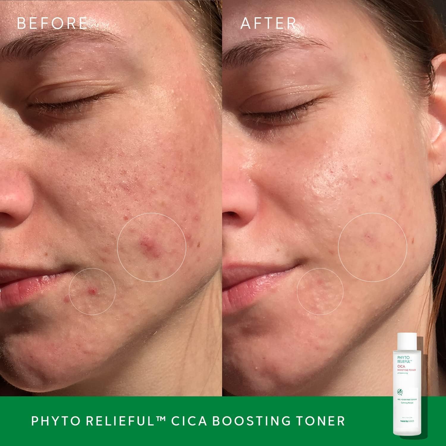Phyto Relieful Cica PHA LHA Boosting Toner