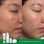 Phyto Relieful Cica PHA LHA Boosting Toner