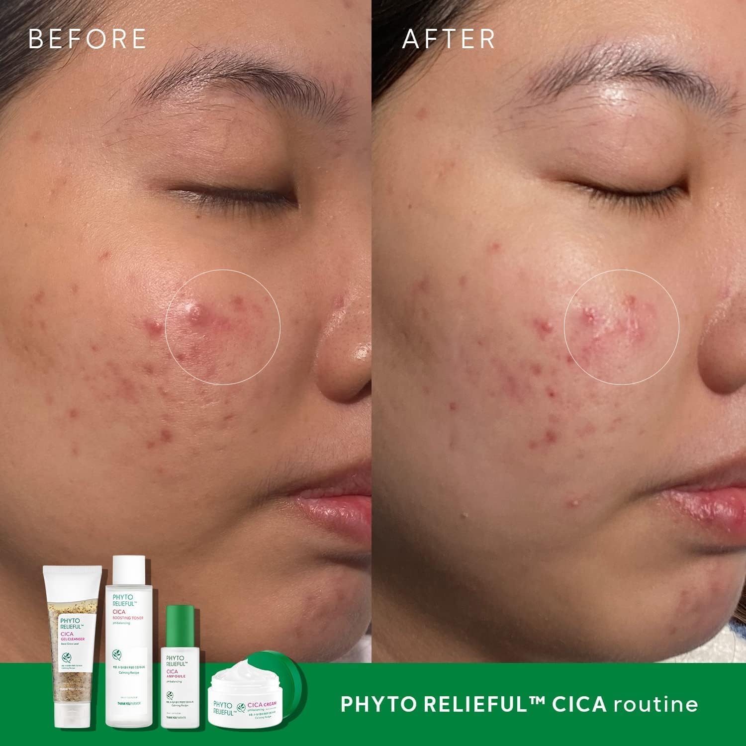 Phyto Relieful Cica PHA LHA Boosting Toner