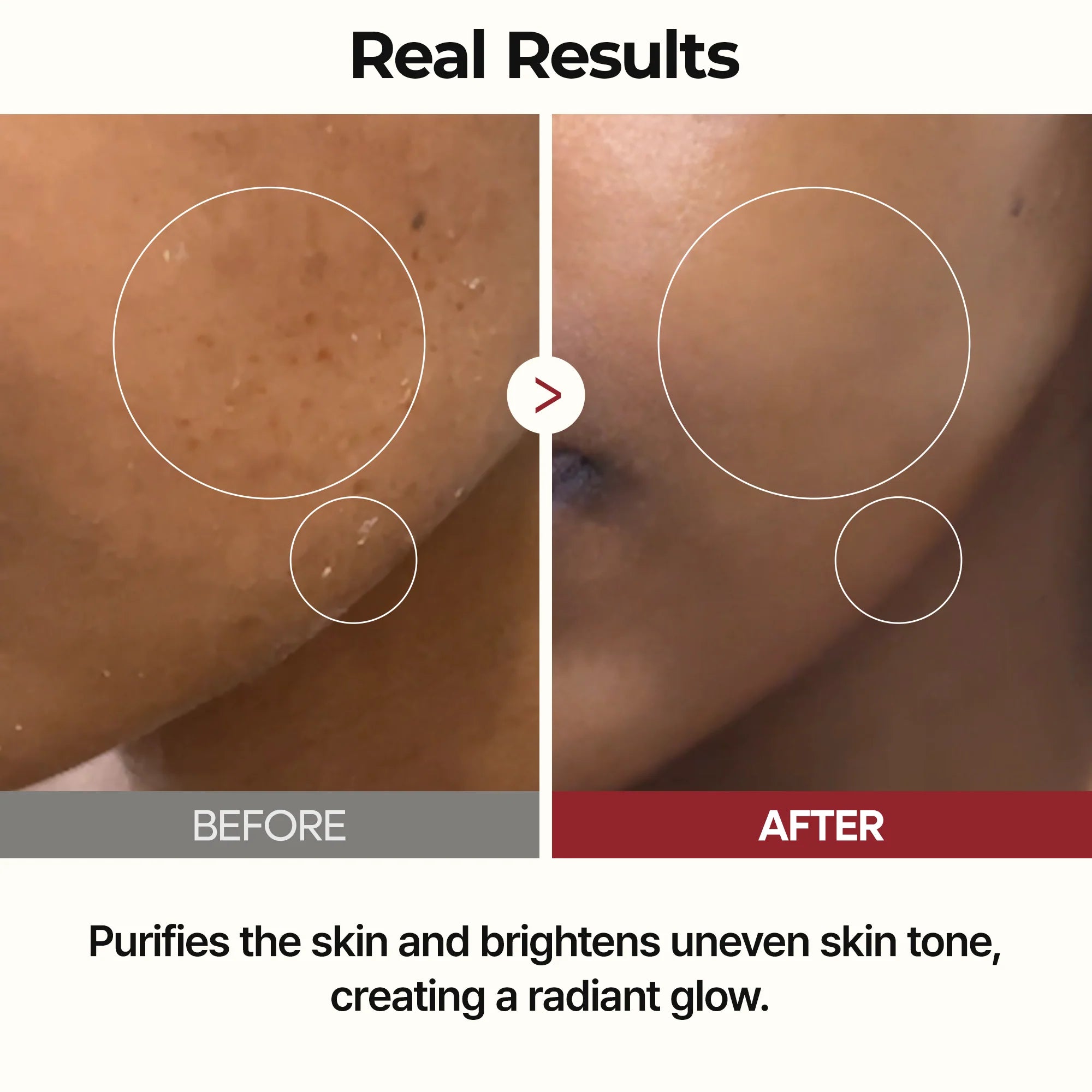 PeelShot Rice Ampoule