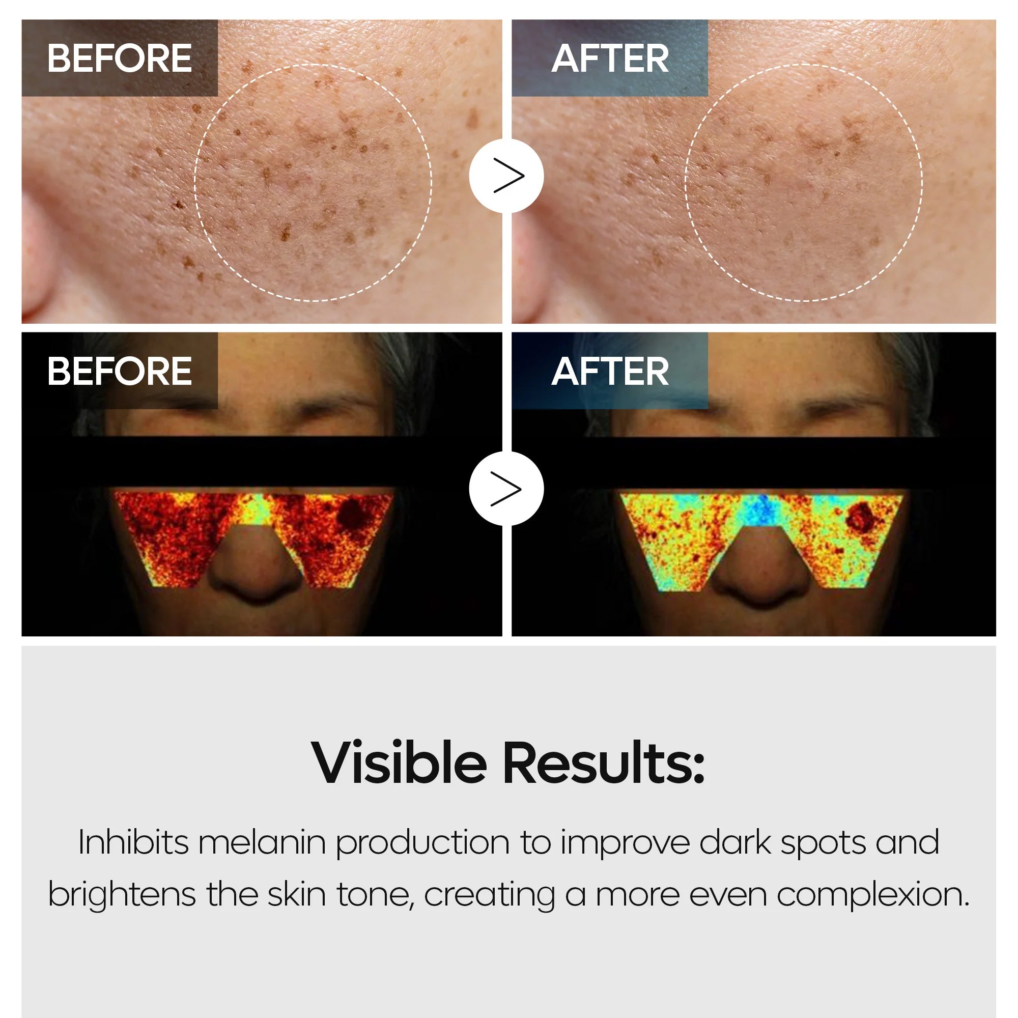 TX Peeling Toner
