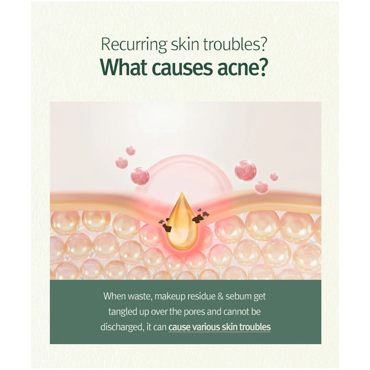 Calming Acne Cleansing Foam 100ml